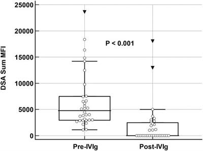 Preemptive Treatment of De Novo Donor Specific Anti-HLA Antibodies With IVIG Monotherapy after Lung Transplantation